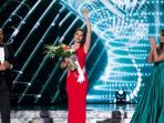 miss-slovenia-dengan-wajah-lumpuh-sebelah_20151224_192902.jpg