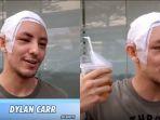 sadar-berkat-keajaiban-dylan-carr-ngaku-aneh-dengan-penampilan-baru-sahabat-ammar-zoni-kini-botak.jpg