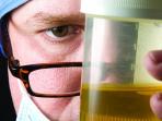 terapi-urine.jpg
