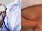 viral-kelalaian-dokter-kandungan-saat-lakukan-operasi-caesar-wajah-bayi-alami-cacat-seumur-hidup.jpg