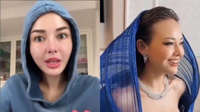 Amanda Manopo Kian Kurus dengan Pipi Tirus, Operasi Plastik?