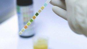 warna-tes-urine.jpg