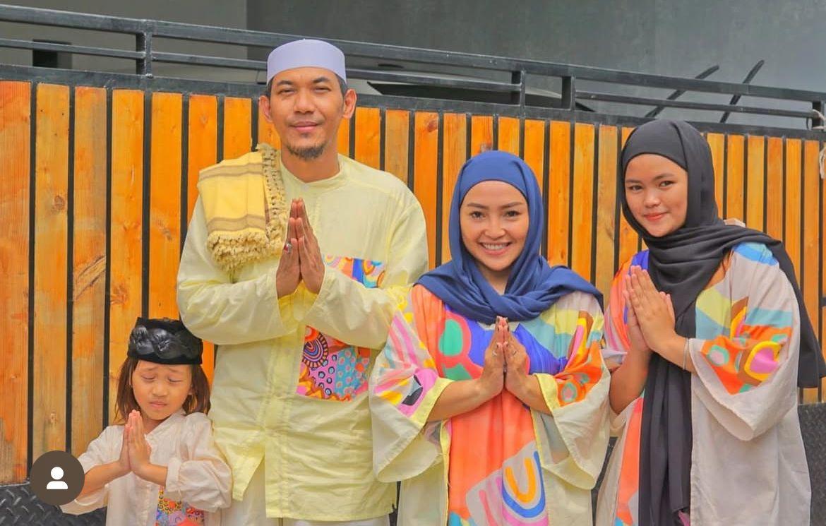 Mpok Alpa Tutupi Penyakit Serius dengan Dalih Rambut Rontok Saat Menyusui
