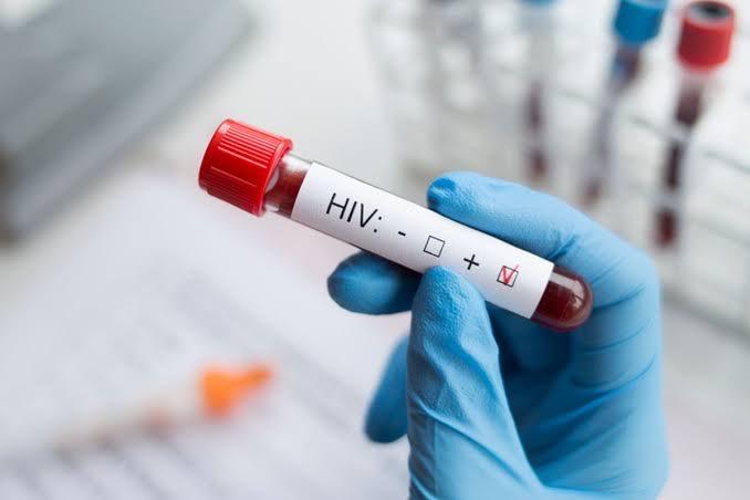 Nyaris-300-Kasus-HIVAIDS-di-Palu-dalam-17-Bulan-Terakhir-Dinkes-Soroti-Kelompok-Rentan.jpg
