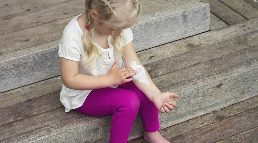 8 Tips Mencegah Terjadinya Eksim di Saat Cuaca Dingin