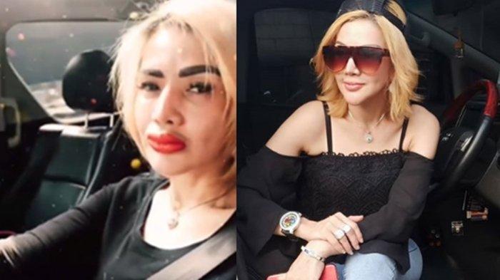 penampilan-barbie-kumalasari-sebelum-dan-sesudah-sulam-bibir.jpg