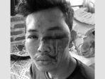 fandi-wahyudi-warga-patumbak-yang-diculik-dan-disiksa-oknum-tni.jpg