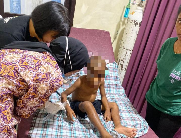 Anak-korban-kekerasan-di-Kota-Jayapura.jpg