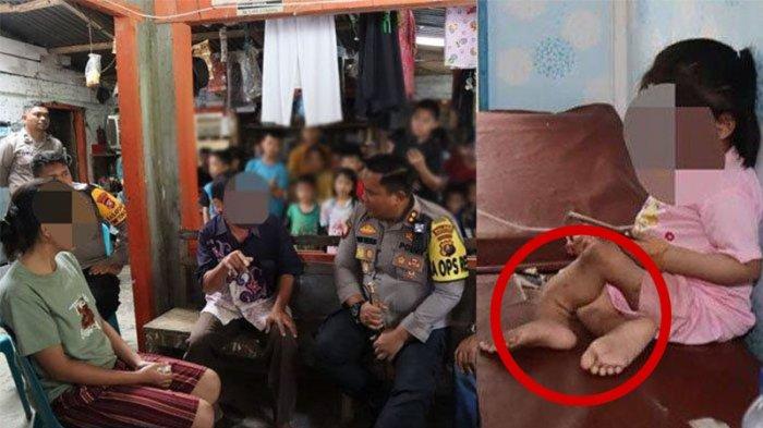 Begini Pengakuan Kakek Bocah 10 Tahun di Nias yang Kakinya Patah, Orangtua NN ke Medan dan Aceh