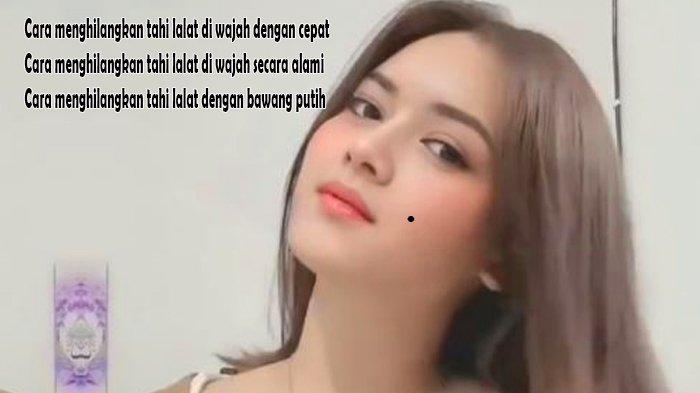 Cara Menghilangkan Tahi Lalat di Wajah dengan Cepat Secara Alami dengan Bawang Putih - Kulit Pisang