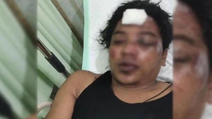 Begal Tak Tahu Lawan, Salah Sasaran ke Atlet Arung Jeram: Berakhir Bonyok