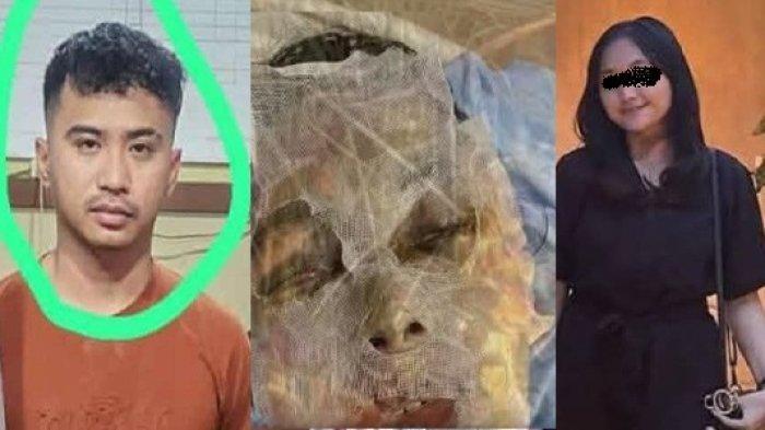 Natasya Disiram Air Keras oleh Eksekutor yang Dibayar Rp 7 Juta, Begini Kondisinya Sekarang