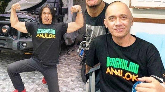 Badan Kurus Botak dan Dirawat di RS, Inilah Penampilan Agung Hercules yang Berubah Drastis
