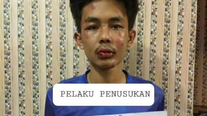 Polisi: Alfin Andrian Penikam Syekh Ali Jaber Dipastikan Tidak Gila, Ini Pengakuannya kepada Polisi