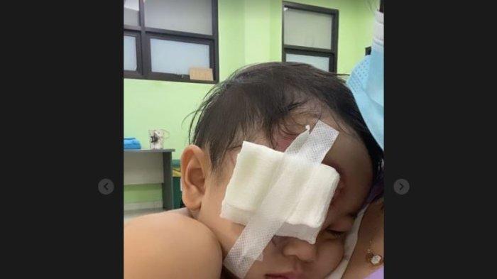 Kondisi Gala Anak Vanessa Angel Diposting Adik Bibi, Wajah Kirinya Penuh Luka Lebam