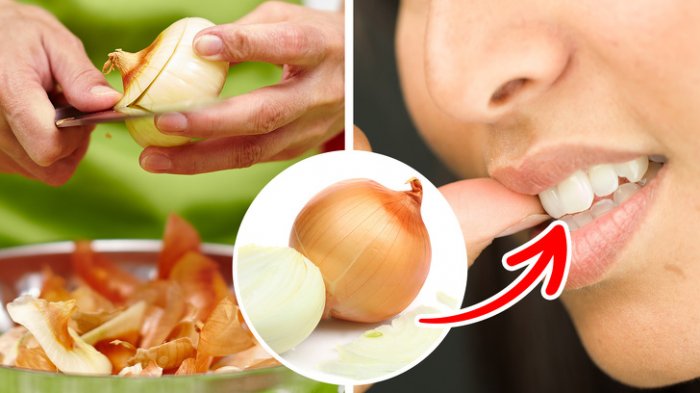 Mudah, Begini Cara Menghilangkan Sakit Gigi Menggunakan Bahan Alami