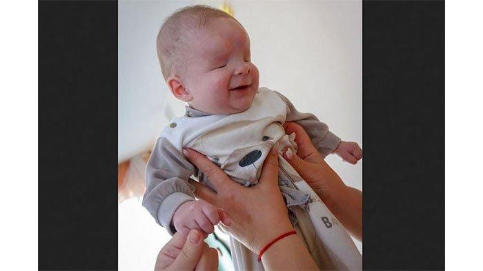 Kisah Pilu Bayi Sasha, Seumur Hidup tak bisa Melihat, Kedua Orangtua Justru Lepas Tangan