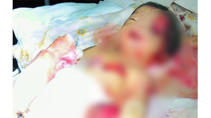 Dirawat di Rumah Sakit, Bayi 10 Hari Malah Meninggal Digigit Tikus