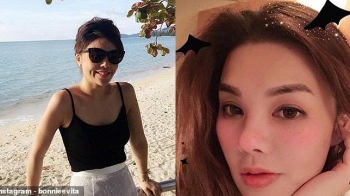 Wanita Pewaris Perusahaan Bisnis Fashion Ini, Tewas di Korea Selatan Saat Operasi Payudara