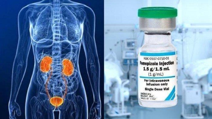 Seperti Ini Cara Kerja Fomepizole, Obat yang Didatangkan untuk Obati Gagal Ginjal Akut Misterius