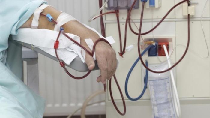 Harapan Pasien Cuci Darah Kandas di Tangan MA! Permohonan Pembatalan Kenaikan Iuran BPJS DITOLAK