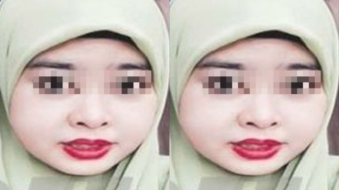 Coba-coba Pakai Produk Kecantikan Baru, Wanita Ini Langsung Trauma! Nasib Sial Menimpanya