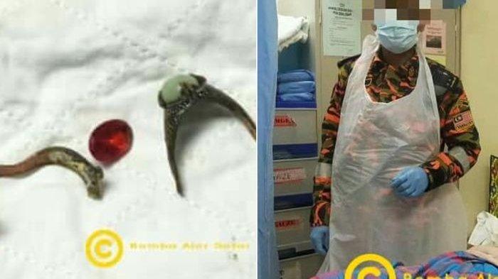 Bikin Ngilu, 2 Cincin Tersangkut di Alat Kelamin Pria Ini: Petugas Pakai Ring Cutter