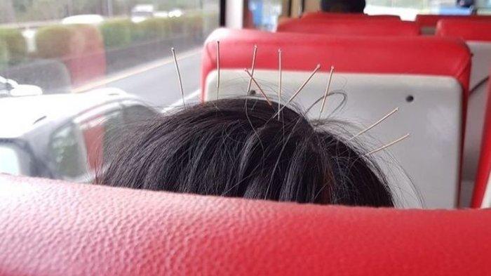 VIRAL Foto Kepala Wanita dengan Tusukan Jarum di Bus: Akupuntur Yah Bund?