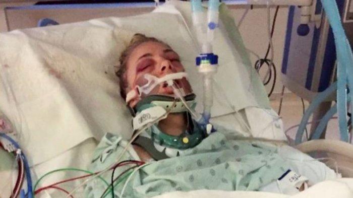 HALUSINASI Sabu Semakin Mengerikan, Wanita di AS ini Congkel Bola Matanya Sampai Keluar