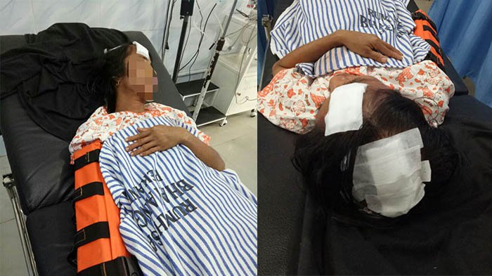 Pengakuan Korban Terduga Begal, Langsung Ditendang Sampai Terpental dari Motor