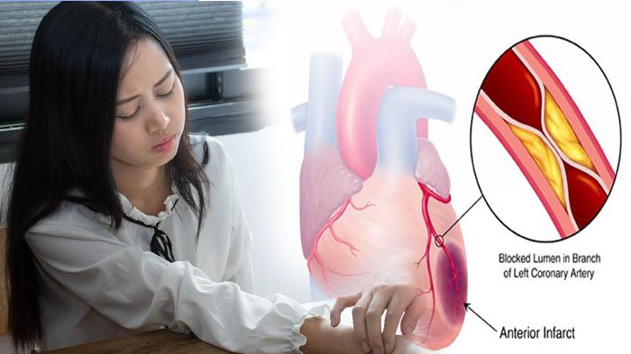 5 Cara Mencegah Penyakit Jantung Datang Kembali