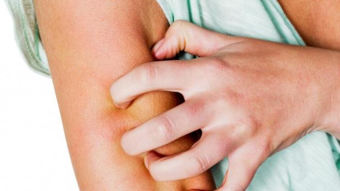 2 Bulan Perawatan Biar Kulit Putih, Wanita Ini Langsung Trauma, Malah Dapat Penyakit Kronis Ini