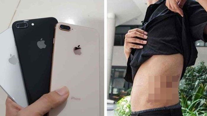 VIRAL Jual Ginjal Demi Beli iPhone, Begini Nasib Pria Ini Sekarang