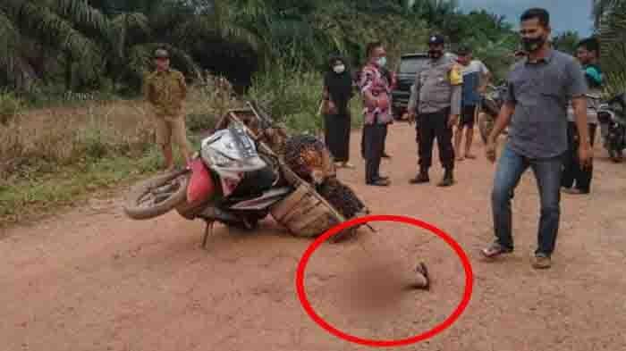 Ngeri, Kaki Muhdanial Putus Dibacok, Inilah Kronologi Lengkap Penganiayaan di Bangko Pusako