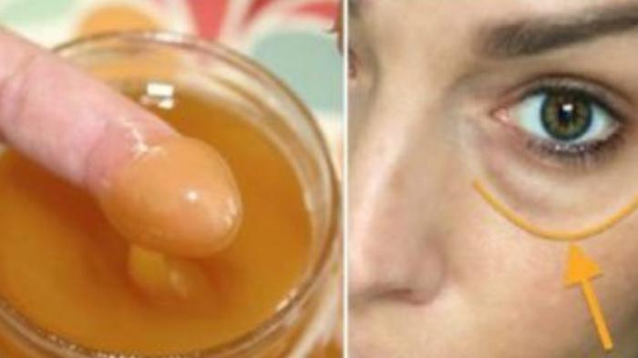 CARA Menghilangkan Kantung Mata: Pakai Bahan Alami Hilangkan Mata Panda