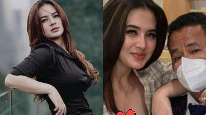 Kasian Aspri Hotman Paris, Video Hidung Berdarah dan Mengerang Sakit Tersebar, Ada Apa Sebanarnya?