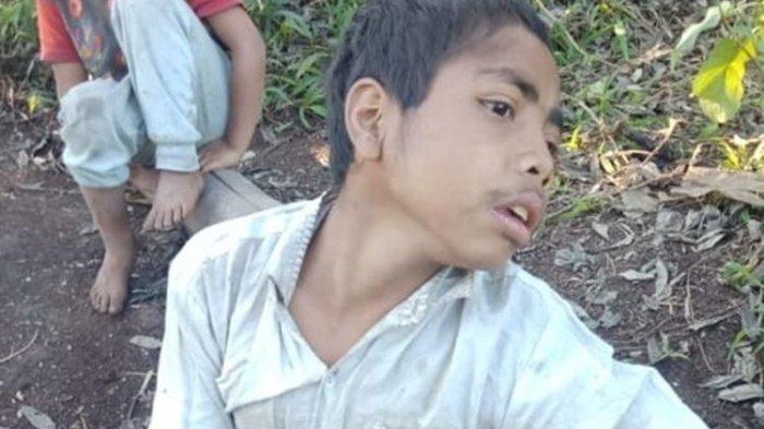 Umurnya 16 Tahun, Lumpuh Sejak Lahir, Kursi Roda Ristan Sampai Saat Ini Hanyalah Sebuah Mimpi