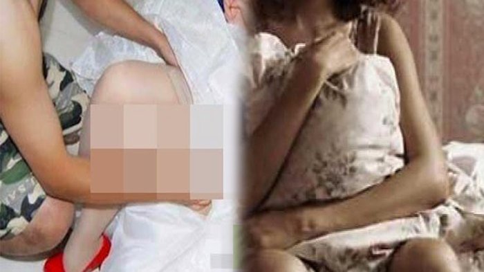 Pengantin Wanita Tewas Pendarahan di Malam Pertama, Ternyata Suami 'Psikopat'