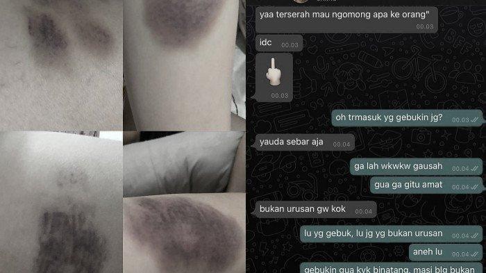 Tubuh Memar Ditonjok dan Wajah Hampir Disetrika, Kisah Cewek Terjebak Toxic Relationship Viral
