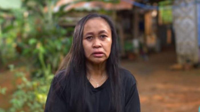 Syok, Dari Cantik jadi Nenek-nenek, Ortu Sampai Nangis LIhat Wajah Anak Gadsinya