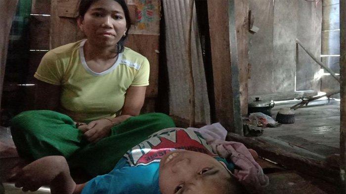 Lumpuh, 2 Saudara Sepupuan Ini Hidup dari Belas Kasih Tetangga, Belum Tersentuh Bantuan Pemerintah