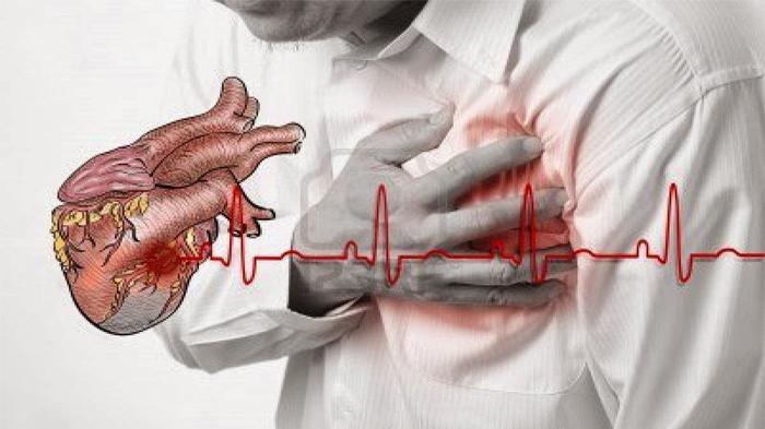 Hati-hati Ini 6 Gejala Serangan Jantung