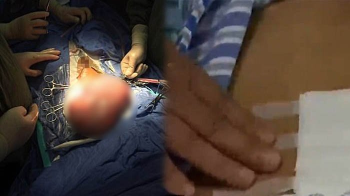 Ribuan Janin Menumpuk di Septic Tank,Ternyata Praktek Klinik Aborsi di Jakarta Ini Begitu Mengerikan