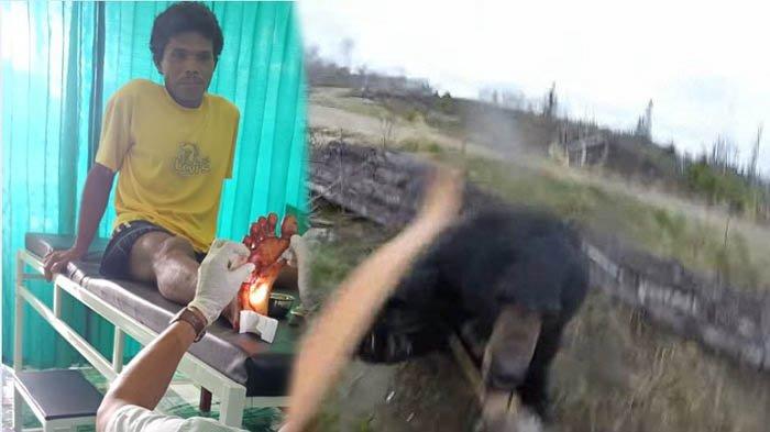 Penyadap Karet Gantikan Posisi Istri yang Dikejar Beruang, Kaki Sapri Robek Diserang Beruang Madu