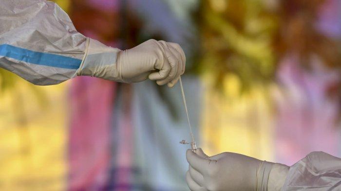 Pasien Positif Covid-19 Yang Sudah Jalani Isolasi Mandiri 10 Hari Dinyatakan Sembuh, Tak Perlu Swab
