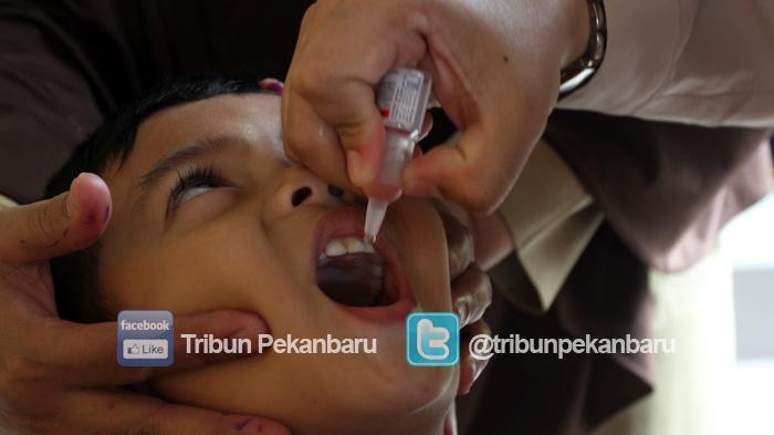 Menyerang Sistem Saraf, Ketahui Gejala Polio, Lakukan Pencegahan Dini