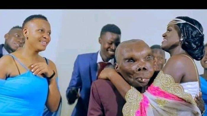 Ingatkah Sama Pria Terjelek di Uganda, Ia Beru Saja Menikahi Gadis Muda, Resmi Jadi Istri ke-3