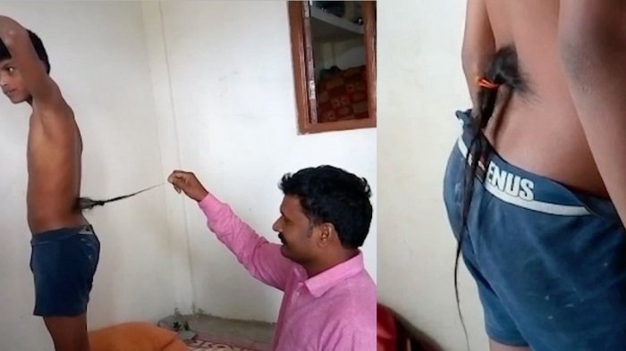 Punya Ekor Aneh, Remaja Ini Dianggap Dewa, Banyak yang Menyentuh Kakinya Minta Berkat