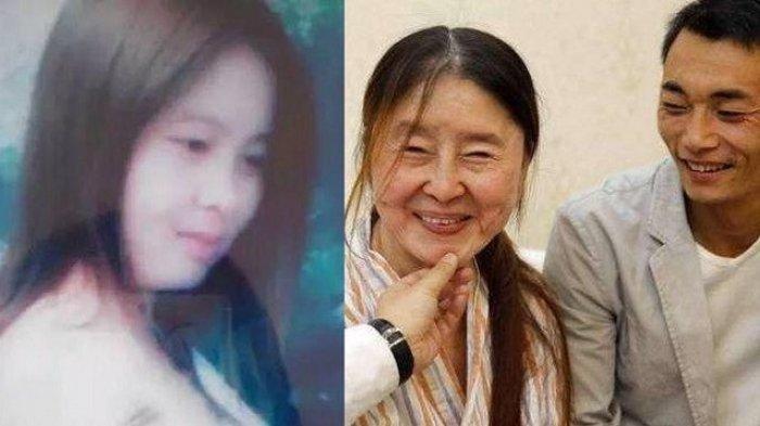 Reaksi Suami Tak Terduga, Wajah Cantik Wanita ini Berubah Keriput Bak Nenek-nenek dalam Semalam