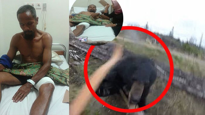 Beginilah Kondisi Dasril Usai Bergumul dengan 2 Ekor Beruang Madu, Ia Mengalami Luka Serius